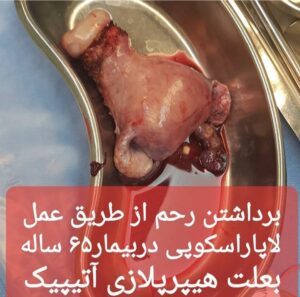 دکتر عفت زادسر در تهران